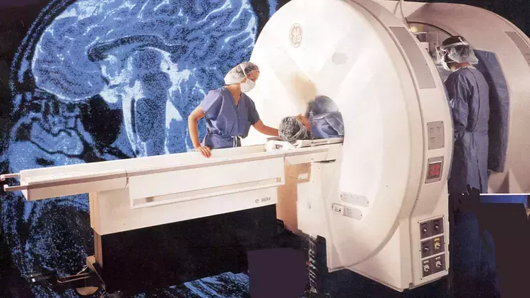 Yapay zekâ, Alzheimer’ı yıllar öncesinden tespit edebilecek
